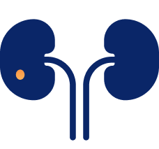 Kidney Stone